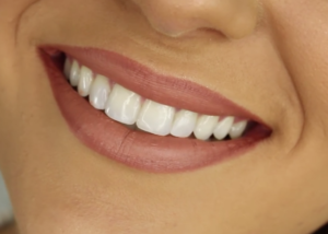 Healthy Smiling Teeth