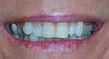Before cosmetic dentist treatment