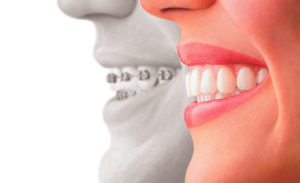 Tips for Choosing the Right Cosmetic Dentist