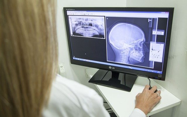 Common signs and symptoms of TMJ
