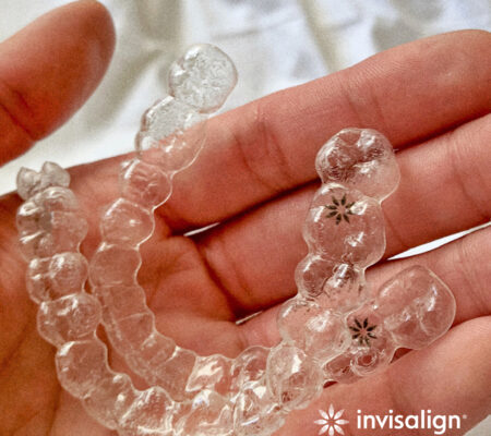 Social Posts for Loyalty 2020_1.Static Image Invisalign aligners on hand for Facebook or Instagram feed (1) Invisalign Albuquerque