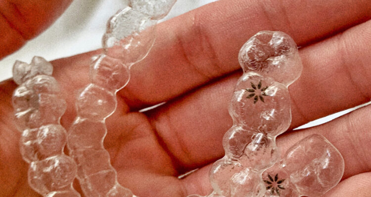 Invisalign Albuquerque